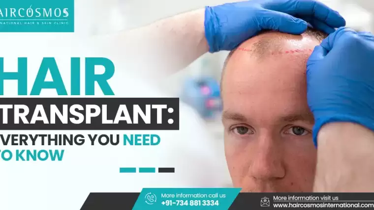 Hair Transplant: Everything You Need To Know