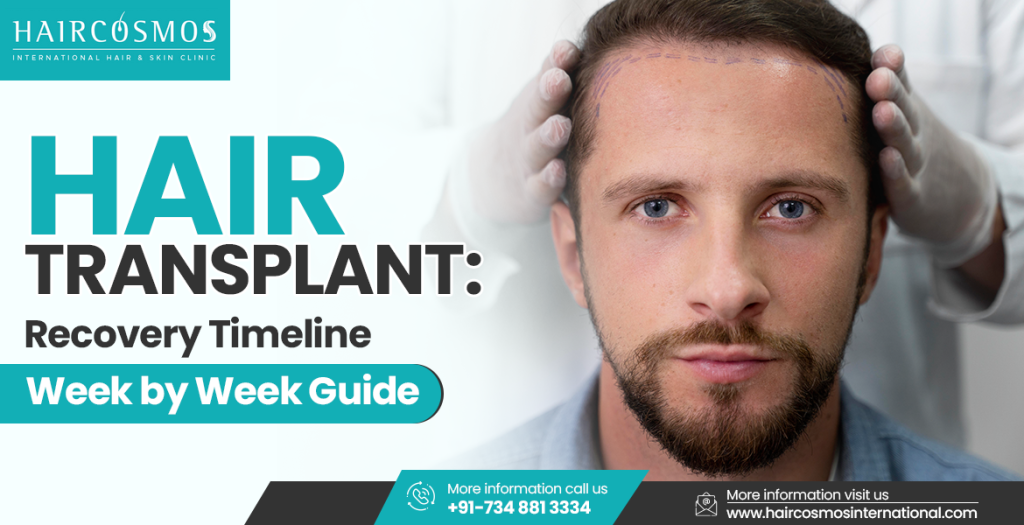 hair transplant recovery timeline